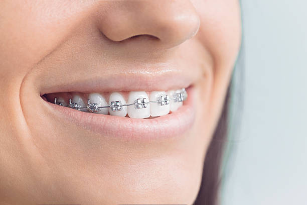 Best Wisdom Tooth Removal  in Hooks, TX